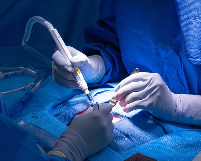 Operating room scene